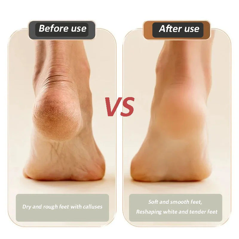 🔥VENTE FLASH💝Nouvelle polisseuse de pieds électrique numérique【LIVRAISON GRATUITE】