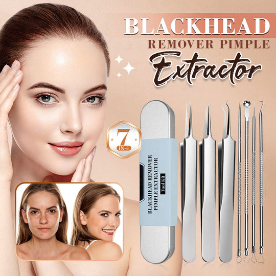 🔥Offre à durée limitée : 50 % de réduction🔥Kit d'outils extracteurs de points noirs en acier inoxydable