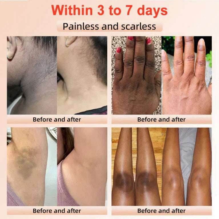 🔥Orange Enzyme Exfoliating Gel — The Gentle Miracle Your Skin Has Been Crying Out For