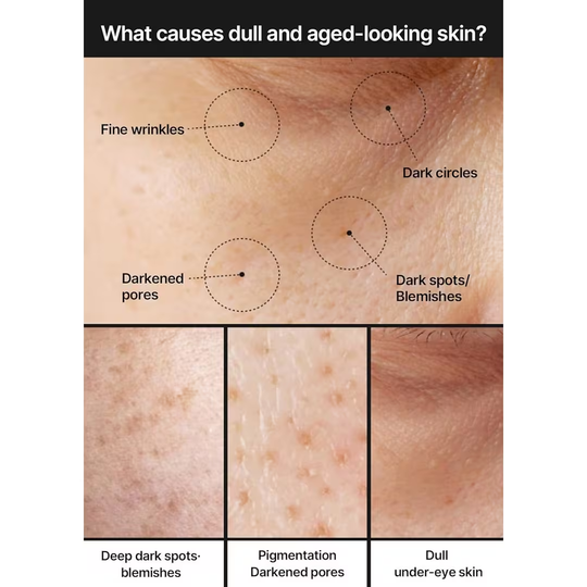 EELHOE Pores + Dark Spots Refining Cream with Arbutin, Niacinamide, Tranexamic Acid & Melazero | Pore-Minimizing, Gentle & Hydrating Daily Moisturizer, Suitable for Sensitive Skin, 50g (1 Pack)
