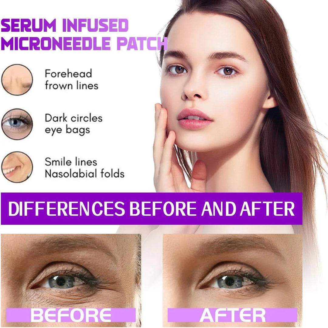 Eyes Patches——TARGETS EYE BAGS & DARK CIRCLES