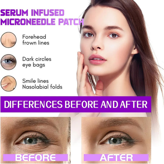 Eyes Patches——TARGETS EYE BAGS & DARK CIRCLES