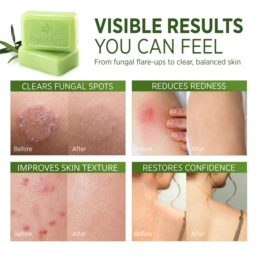 ✨2026 HOT SALE New Arrival🔥 Tea Tree Oil Soap