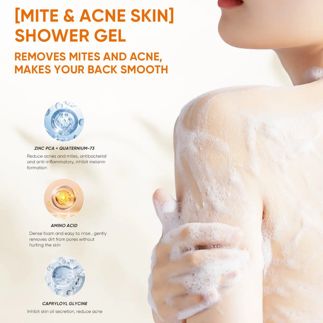 QUARXERY Mite & Acne Cleansing Body Wash 250ml - Anti-Acne & Acne Shower Gel for All Skin Types - Hydrating Formula with Zinc PCA & Quaternium-73