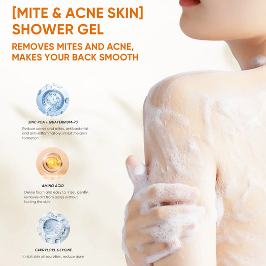 QUARXERY Mite & Acne Cleansing Body Wash 250ml - Anti-Acne & Acne Shower Gel for All Skin Types - Hydrating Formula with Zinc PCA & Quaternium-73
