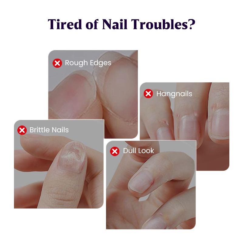 ❗⏰Stock levels are critically low.🔥2025 New Upgraded 3-in-1 Nail Care Pen💅