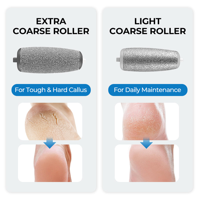 🌸Rajoitetun ajan erikoistarjous!!🌸 Sähköinen jalkakovettumien poistolaite