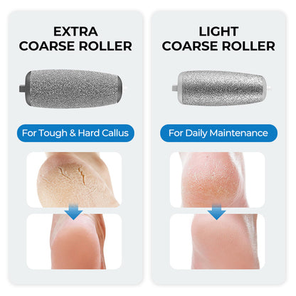 🌸Rajoitetun ajan erikoistarjous!!🌸 Sähköinen jalkakovettumien poistolaite