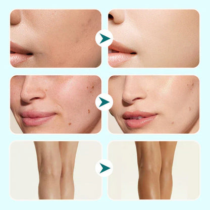 🔥Dernier jour ! 1 acheté, 1 offert !🎁Crème hydratante et correctrice tout-en-un & Couverture 💧✨ Léger & étanche