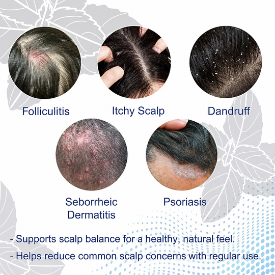 Folliculitis Shampoo for Itchy, Flaky Scalp - Purifying Formula for a Soothed, Balanced Scalp & Oily Scalp Care, Men & Women