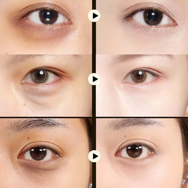 🥑Summer Hot Sale🔥  Avocado Moisturizing Collagen Eye bagMask  60pcs/set