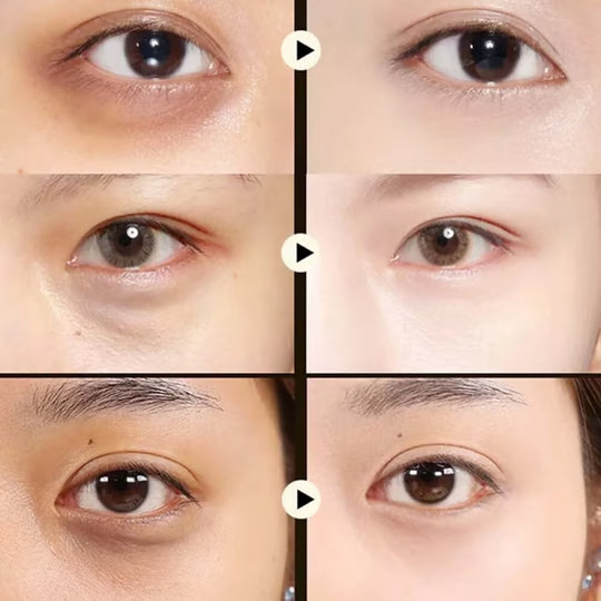 🥑Summer Hot Sale🔥  Avocado Moisturizing Collagen Eye bagMask  60pcs/set