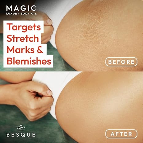 Besque Original Magic Body Oil, Hydrating Skin Care For Full Body That Plumps, Tightens, & Firms Skin With Natural Ingredients, Luxury Spa Gifts