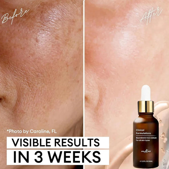5-in-1 Rejuvenate Face Serum – Anti-Aging, Brightening