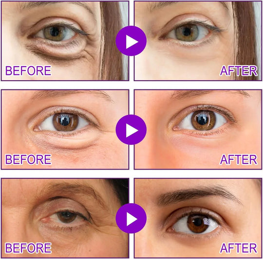 Eyes Patches——TARGETS EYE BAGS & DARK CIRCLES