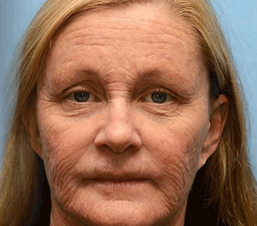 𝑶𝒇𝒇𝒊𝒄𝒊𝒂𝒍 𝑺𝒕𝒐𝒓𝒆👍| Retrouvez une peau jeune maintenant 💫STDEI® BOTOX & VITA A RETINOL SHOT Crème raffermissante anti-rides