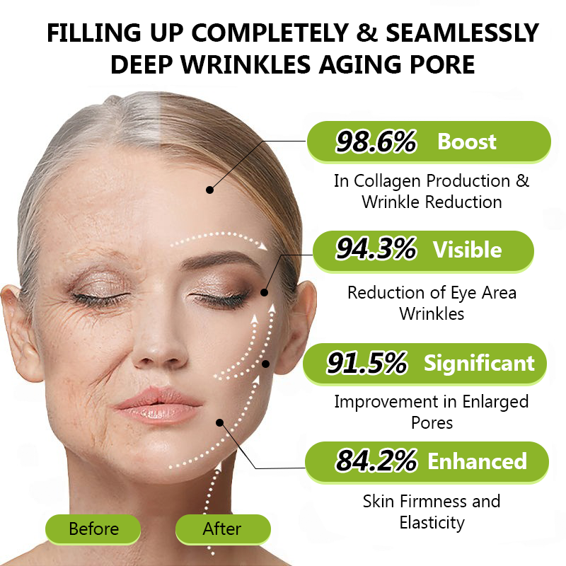 𝑶𝒇𝒇𝒊𝒄𝒊𝒂𝒍 𝑺𝒕𝒐𝒓𝒆👍| Retrouvez une peau jeune maintenant 💫STDEI® BOTOX & VITA A RETINOL SHOT Crème raffermissante anti-rides