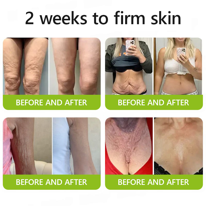 𝑶𝒇𝒇𝒊𝒄𝒊𝒂𝒍 𝑺𝒕𝒐𝒓𝒆👍| Retrouvez une peau jeune maintenant 💫STDEI® BOTOX & VITA A RETINOL SHOT Crème raffermissante anti-rides