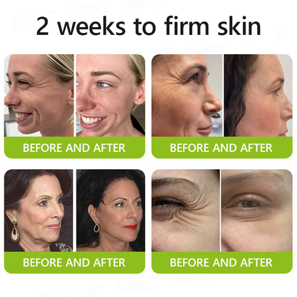 𝑶𝒇𝒇𝒊𝒄𝒊𝒂𝒍 𝑺𝒕𝒐𝒓𝒆👍| Retrouvez une peau jeune maintenant 💫STDEI® BOTOX & VITA A RETINOL SHOT Crème raffermissante anti-rides