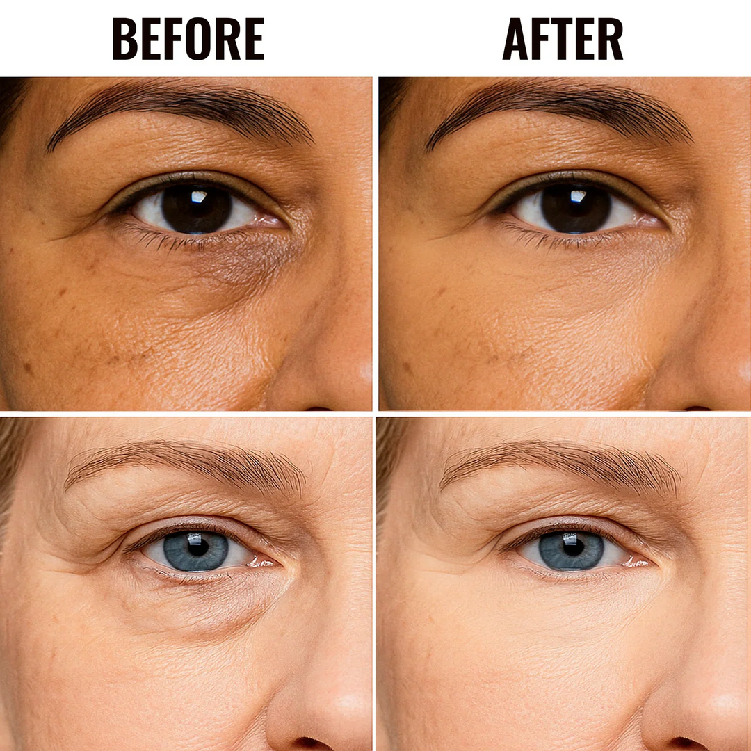 ✨ DERNIER JOUR DE PROMOTION ! 1 ACHETÉ = 1 OFFERT✨Correcteur illuminateur pour le contour des yeux & Atténuer les cernes