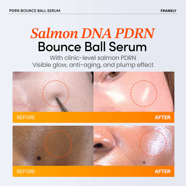 🔥Limited Time Promotion🔥 FRANKLY PDRN Bounce Ball Serum 30ml
