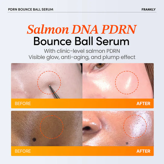 🔥Limited Time Promotion🔥 FRANKLY PDRN Bounce Ball Serum 30ml