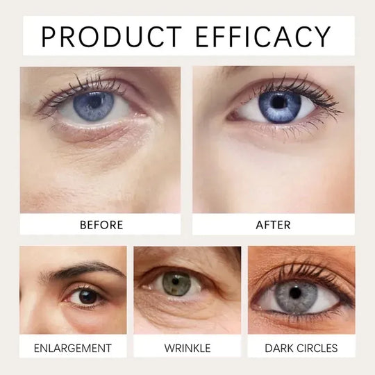 Elycura™ Flattens the Look of Under-Eye Bags in 10 Seconds