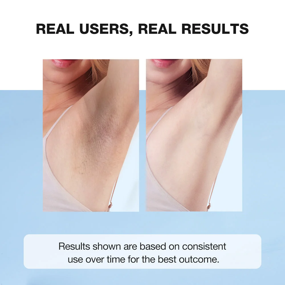 SKINEVER Brightening Deodorant Underarm Cream