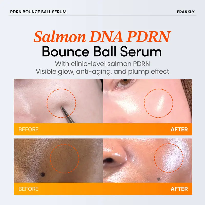 [FRANKLY] PDRN Bounce Ball Serum | 99% Pure Salmon DNA Moisturizer for Skin Repair & Glow Skin | Barrier Repair, Glow Skin, Plumping Effect, Korean Skincare, Lightweight