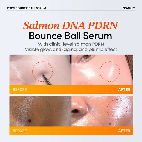 [FRANKLY] PDRN Bounce Ball Serum | 99% Pure Salmon DNA Moisturizer for Skin Repair & Glow Skin | Barrier Repair, Glow Skin, Plumping Effect, Korean Skincare, Lightweight