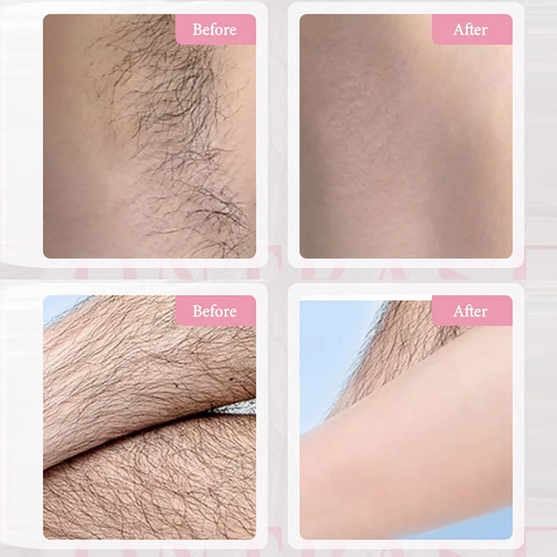 Gentle & Effective Hair Removal Cream