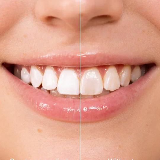 💗Last Day Special Price! ⚡50K+ SOLD!💝Instant Whitening Tooth Paint