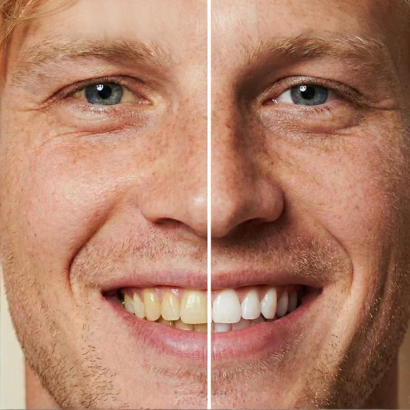 💗Last Day Special Price! ⚡50K+ SOLD!💝Instant Whitening Tooth Paint