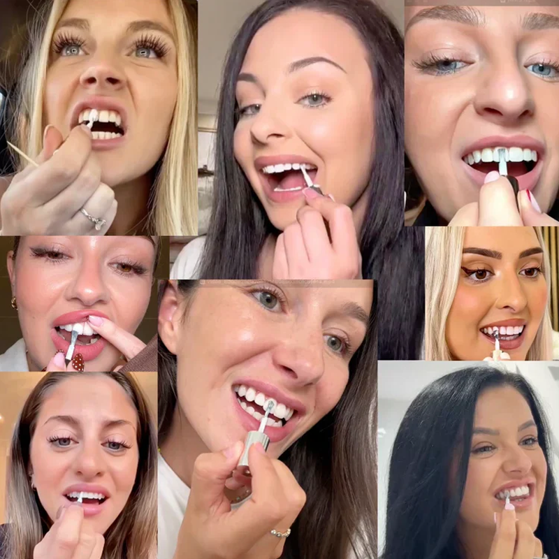 💗Speciální cena posledního dne! ⚡PRODÁNO 50 000+!💝Okamžité bělení zubní barvy