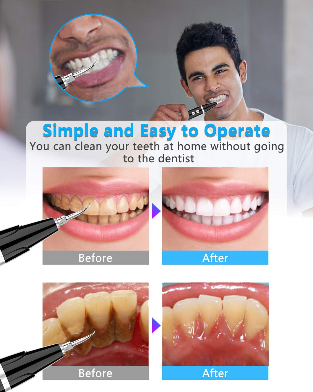 Electric Teeth Cleaner
