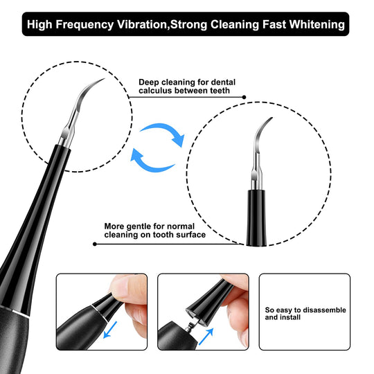 Electric Teeth Cleaner