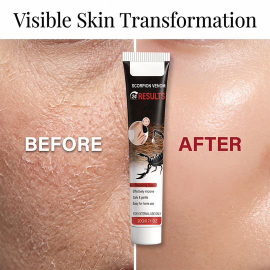 Scorpion Venom Skin Revitalizing Cream